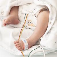 Neugeborenes auf der Neonatologie mit Sensoren